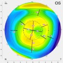 눈사람안과의원 이미지