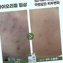 올가드림뷰티 여수본점 | 이젠 안녕! 내 얼굴의 홍조와의 찐친 결별 선언