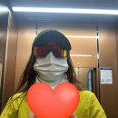 원레이져 | 사마귀 제거 | 수원, 용인, 성남 편평사마귀 무제한 얼굴 10만원대 후기 | CO2 레이저 | 편평사마귀 재발