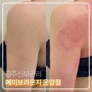 에이브라운지 | 광주 신부관리 에이브라운지 운암동 팔뚝 승모근 관리 후기