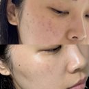 파이안경 | [내돈내산] 비글자매 리쥬연어 퍼밍크림 &amp; 파이토브루 (PDRN) 밸런싱 크림 후기