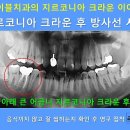 에이블치과기공소 이미지