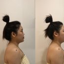 오월로 | 광주피부관리 오월에스테틱 JH윤곽술 후기, 얼굴라인 정리 만족