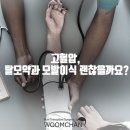 움찬의원