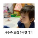 (주)지오크리에이티브 | 아기 사두증, 교정헬멧 5개월 착용 후 정상 범위 안착. 장단점과 지오헬멧 솔직후기