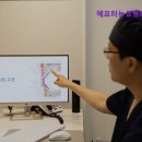 애프터눈성형외과의원 네이버블로그