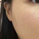 라미메디 이미지