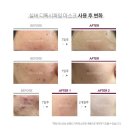 디톡시 이미지