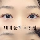 베네브로우