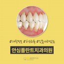 대구잇몸이식 치은퇴축, 뿌리노출 드러나는데 방치해도 될까?