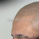 프로스칼프부산 이미지