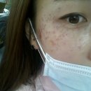 강남 우태하 피부과 시술후기