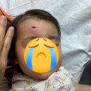 아문성형외과의원 | (응급상황)31개월 아이 이마찢어짐/이마 봉합수술/주말 봉합수술 가능한병원/아문성형외과
