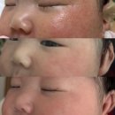 구센치 | [태열 크림 추천] 하우파파 , 일센치 약모밀 내돈내산 후기