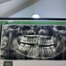 강동이건치과의원 이미지