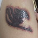 지움의원 | 인천 컬러타투제거 4회차(+1회차) 나 진쯔 마는 일이 잇엇따.😭[내돈내산 일기]