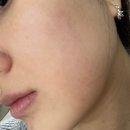 [서울 왕십리피부관리] 더트리니티스파 (옥수동스파, 스파미스트)