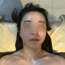 튤립스 에스테틱 네이버블로그