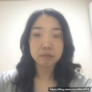 신진광택 | 갈바닉 얼굴마사지기 비프록셀 일주일 찐사용후기