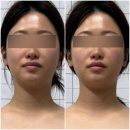 로온 | 로온에서 경험한 얼굴·두상 밸런스 케어 |부산 서면 로온 후기