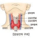 갑상선 미분화암 (Undifferentiated thyroid cancer) 이미지