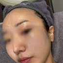 네오엑스 | 신부관리 10편. 제네오엑스 효과 제대로 본 본식 직전 관리 후기