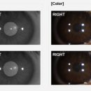 해맑은안경원 이미지