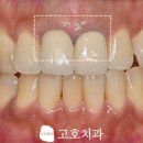 고호치과의원 이미지