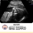 (주)정선환경 | 임신 20~22주차 정밀초음파 검사 시기 장기 검사 항목 후기