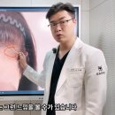 유리헤어라인