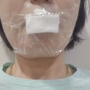 피부과] 평생 콤플렉스 탈출! 월드베스트의원 입술 필러 내돈내산 솔직 후기 (feat. 레스틸렌 2차 리터치)