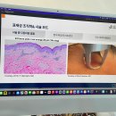 [울트라클리어 후기] 7일차 경과부터 홈케어 팁까지!