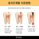 다비드치과 이미지