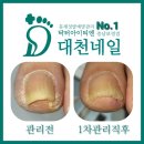 닥터아이티엔대천네일