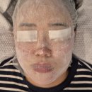 향남환승터미널 | 향남 여드름 관리로 유명한 향남 에스테틱 터닝에스테틱 성인 여드름 관리 후기
