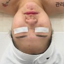 (주)대원크리닝 | [청주] 용암동피부관리 세멘시트 관리, 예소뷰티 - 세멘클리닝