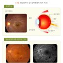 당뇨신문 이미지