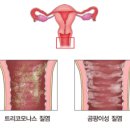 노랑약국 이미지