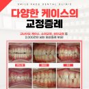 서울교정치과기공소 이미지