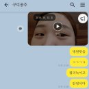 애교살필러 뉴라미스 후기 및 애교필러녹이기 히알주사 가격