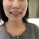 청담한의원 | 청담역 턱관절 한의원 후기｜3D 스캔으로 확인한 안면비대칭 교정 치료