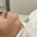 빛담뷰티크 | 경산피부관리 빛담뷰티크 V라인 파동리프팅 후기