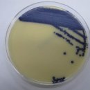 VRE 배지 성상(Enterococcus faecium - Group D)-Brilliance VRE AGARE &amp; 크롬 VRE 배지 이미지