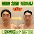용산-407 | 위뷰티용산점 얼굴윤곽정리,쳐진얼굴살 고민이신 분들 맞춤 <턱쉐딩프로그램> 교육후기