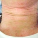 눈꽃피부과의원 이미지