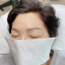 임브로우
