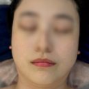 주블룸스킨랩 네이버블로그