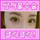남자눈성형후기 놓치지마세요~~