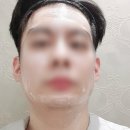 늘푸른피부과의원 네이버블로그