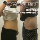 룩스토어 청라언덕점 | 대구 온다리프팅 중구 피부과 바디 리프팅 하복부 10만줄 시술 솔직후기